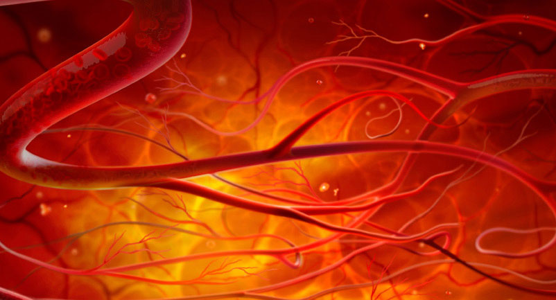 Picture 1 of 3D blood vessels