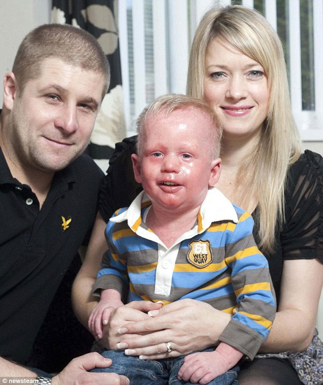 Picture 1 of 3-year-old baby has red skin