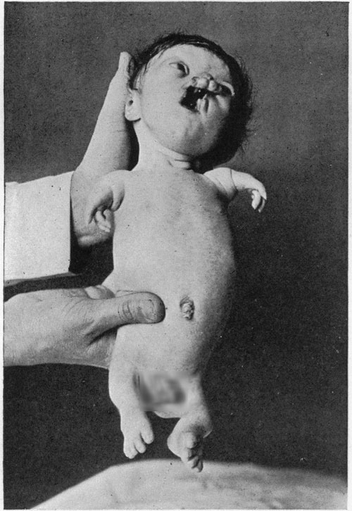 Picture 8 of 4 mistake that ancient scientists believe
