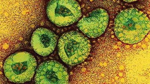 Picture 1 of 4 patients infected with the virus causing SARS were detected