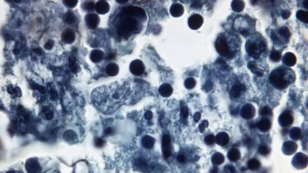 Picture 3 of 4 types of parasites that are extremely dangerous to eat meat