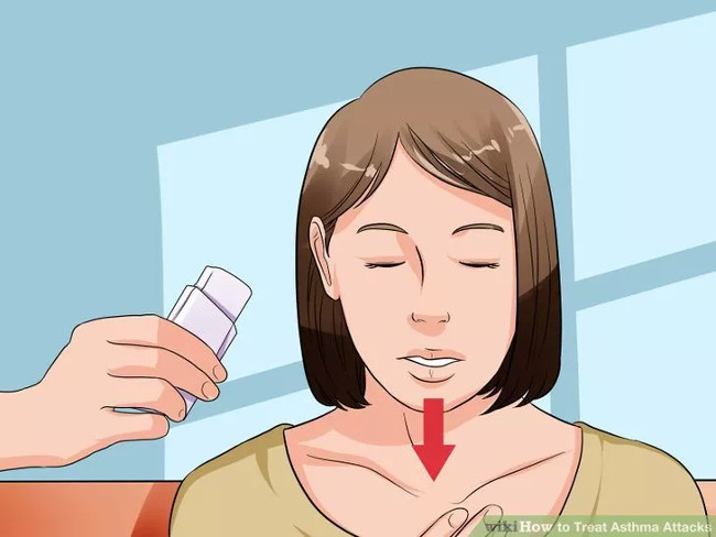 Picture 16 of 4 ways to deal with asthma attacks - bronchial asthma