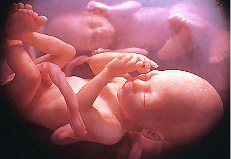 Picture 1 of 4-year-old baby pregnant in the stomach