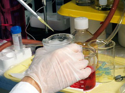 Picture 3 of 5 breakthrough medical advances in the decade