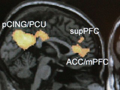 Picture 5 of 5 breakthrough medical advances in the decade