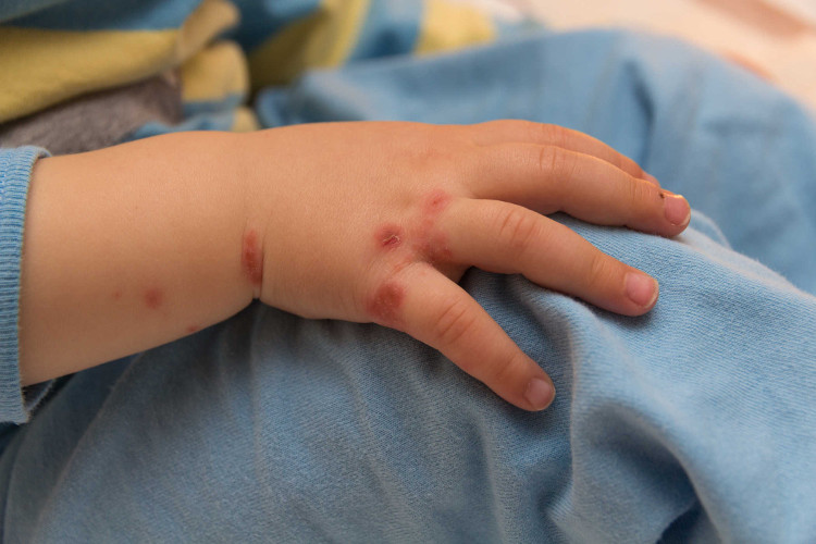 Picture 1 of 5 common diseases that people need to know