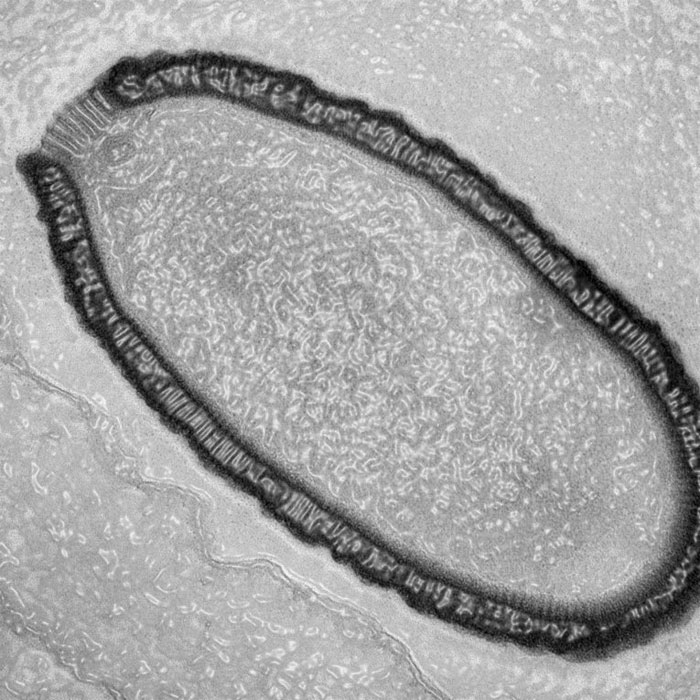 Picture 3 of 5 dangerous diseases that attack humanity due to climate change