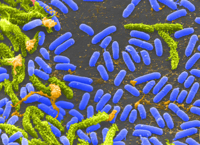 Picture 5 of 5 dangerous diseases that attack humanity due to climate change