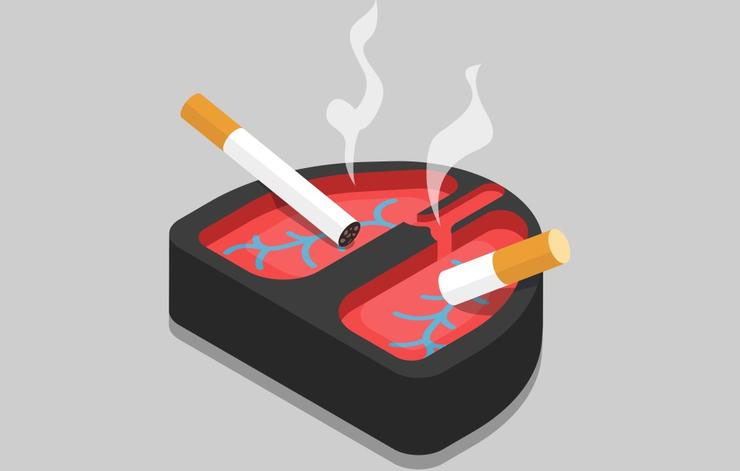 Picture 4 of 5 dangerous diseases that cause prolonged coughing should not be ignored