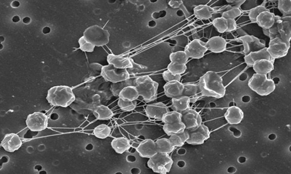 Picture 6 of 5 delicious bizarre creatures on Mars