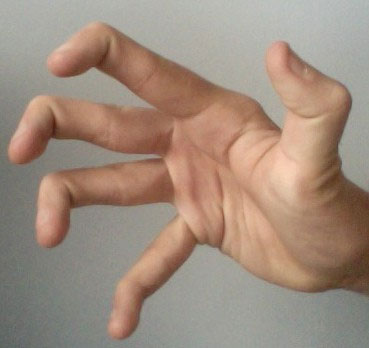 Picture 5 of 5 Extremely rare superpowers you may be possessing without knowing