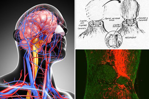 Picture 1 of 5 questions about head transplant