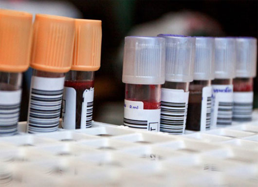Picture 3 of 5 questions without answers about the human body