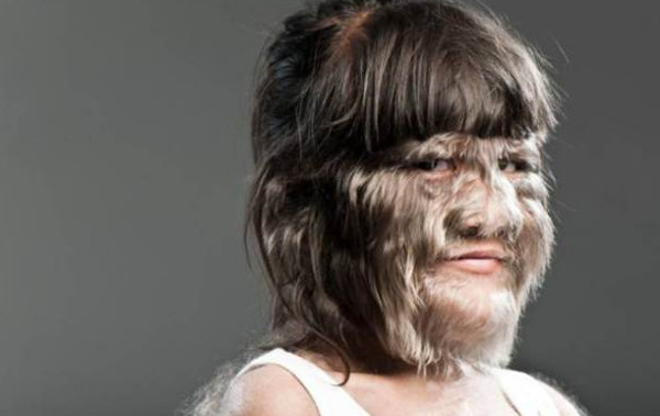 Picture 5 of 5 shocking records on human body parts