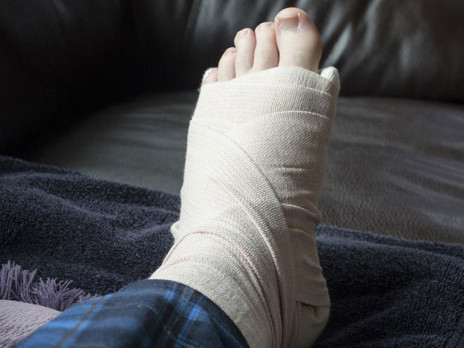 Picture 3 of 5 things people often misunderstand about bones