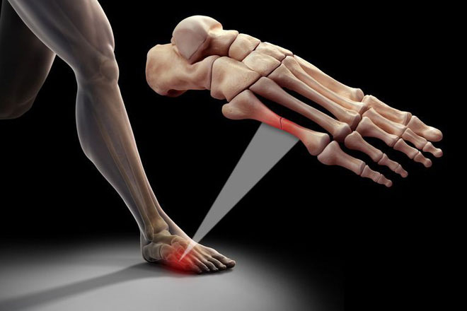 Picture 4 of 5 things people often misunderstand about bones