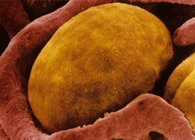 Picture 3 of 5 world medicine breakthroughs 2009