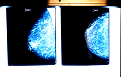 Picture 4 of 5 world medicine breakthroughs 2009
