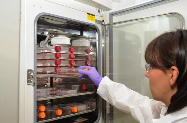 Picture 2 of 50 million tons of human immortal cells are taken from a woman