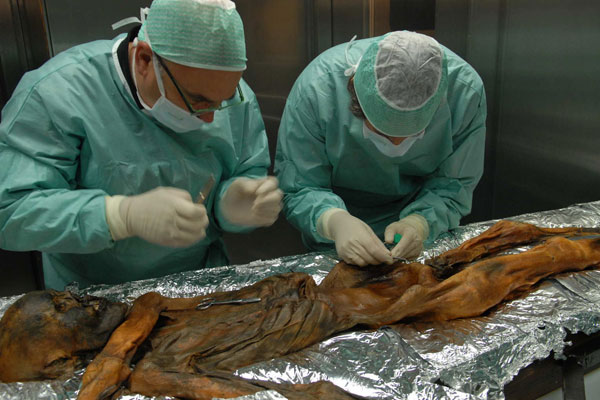 Picture 1 of 5,300-year-old ice-age people with Lyme disease