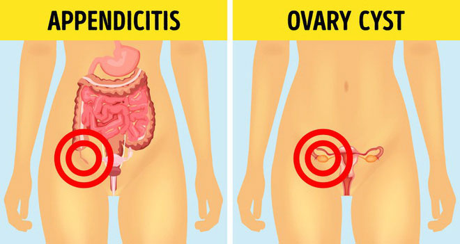 Picture 2 of 6 types of diseases are often easily misdiagnosed to other diseases