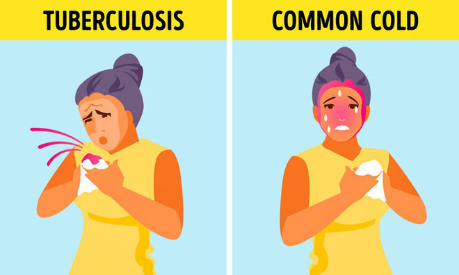 Picture 6 of 6 types of diseases are often easily misdiagnosed to other diseases