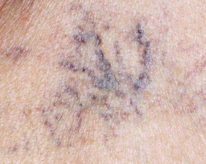 Picture 4 of 6 warning signs of liver problems