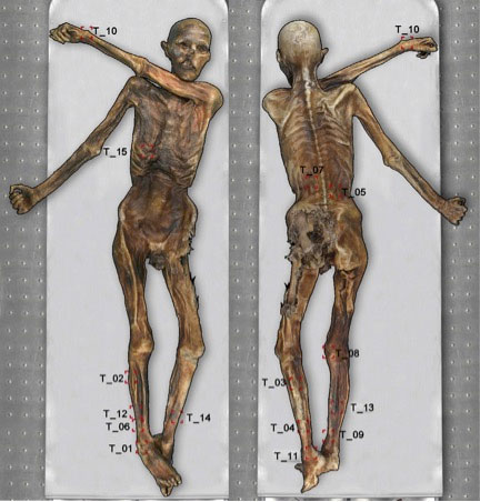 Picture 2 of 61 tattoos were found on the mummy otzi band