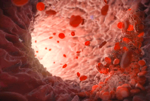 Picture 4 of 7 medical breakthroughs in 2017 make sure you are admiring
