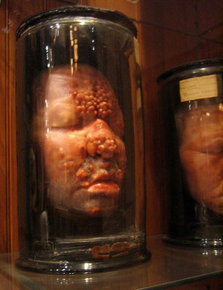 Picture 7 of 7 most horror museums in the world
