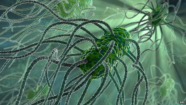 Picture 7 of 7 mysterious diseases that make medicine