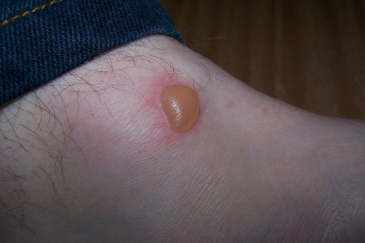 Picture 6 of 7 parts of your body should never scratch, spit, scratch