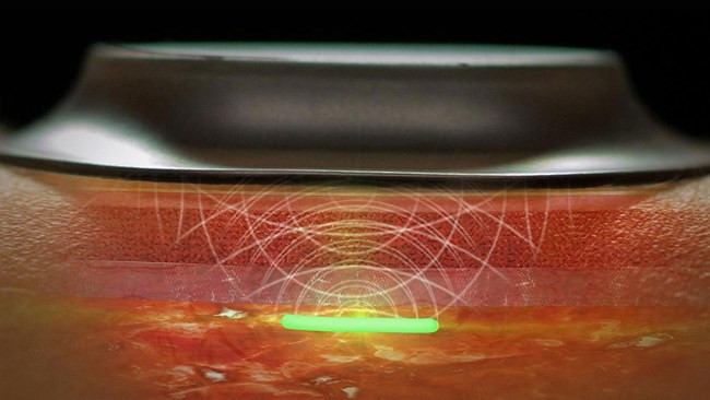 Picture 2 of 7 'Unbelievable' science projects of the US Department of Defense