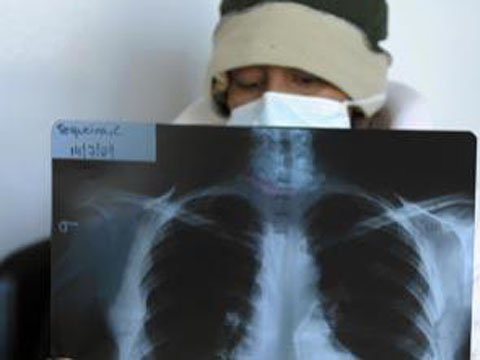 8 misunderstandings 'deadly' about influenza A / H1N1 images 3