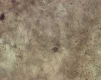 Picture 1 of 8 species of the world's most dangerous invasive microorganisms