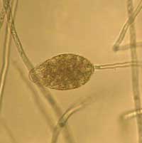 Picture 4 of 8 species of the world's most dangerous invasive microorganisms