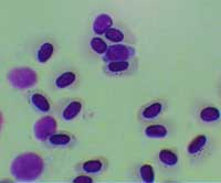 Picture 5 of 8 species of the world's most dangerous invasive microorganisms