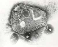 Picture 6 of 8 species of the world's most dangerous invasive microorganisms