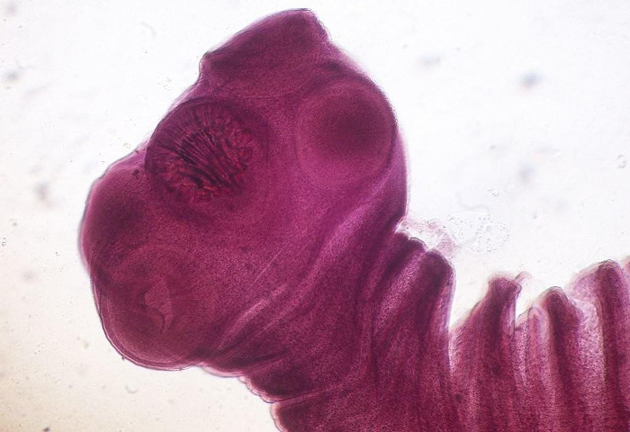 Picture 1 of 8 types of parasites are at risk of hiding in the food you eat every day