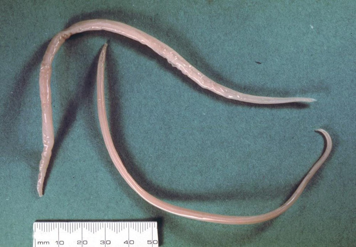 Picture 10 of 8 types of parasites are at risk of hiding in the food you eat every day