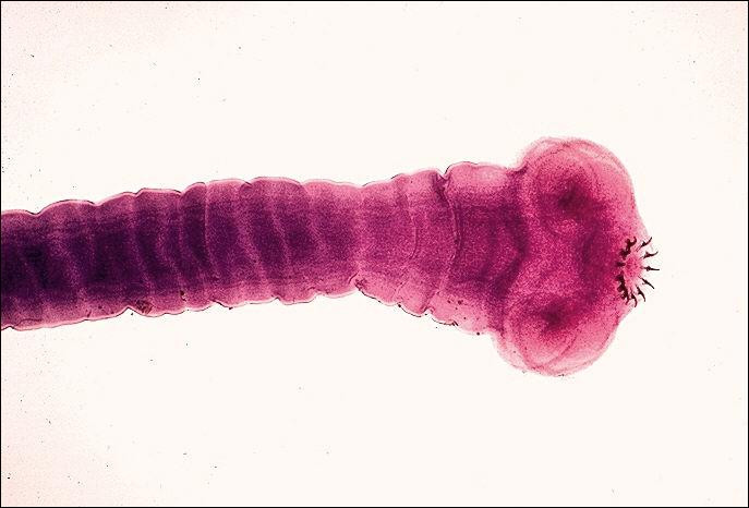Picture 2 of 8 types of parasites are at risk of hiding in the food you eat every day