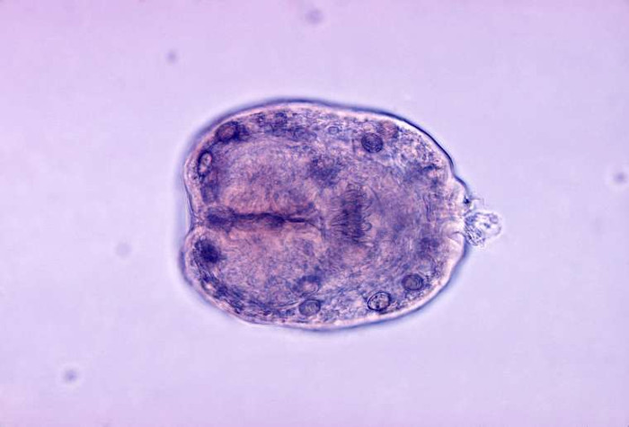 Picture 3 of 8 types of parasites are at risk of hiding in the food you eat every day