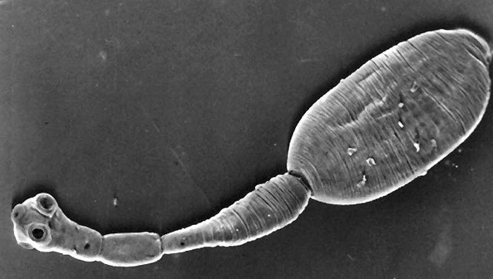 Picture 4 of 8 types of parasites are at risk of hiding in the food you eat every day