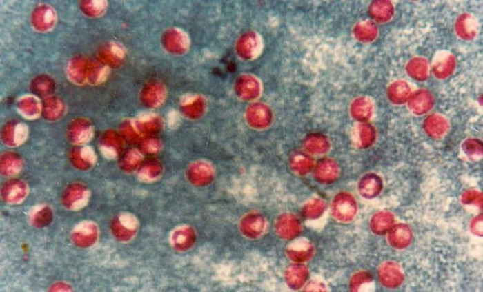 Picture 6 of 8 types of parasites are at risk of hiding in the food you eat every day