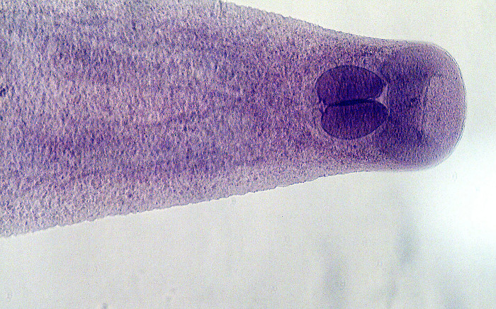Picture 9 of 8 types of parasites are at risk of hiding in the food you eat every day