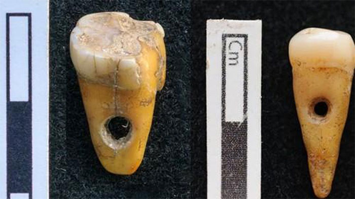Picture 1 of 8,500-year-old human teeth found to be used as jewelry