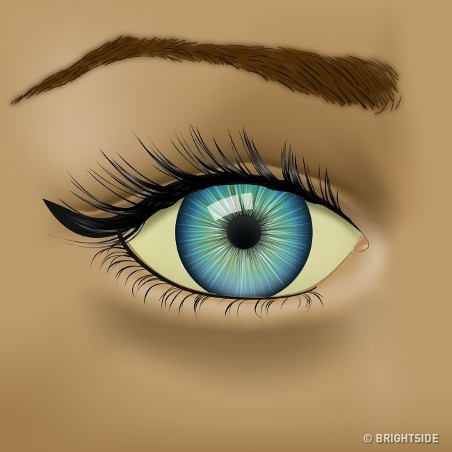 Picture 6 of 9 abnormal signs of eye health problems