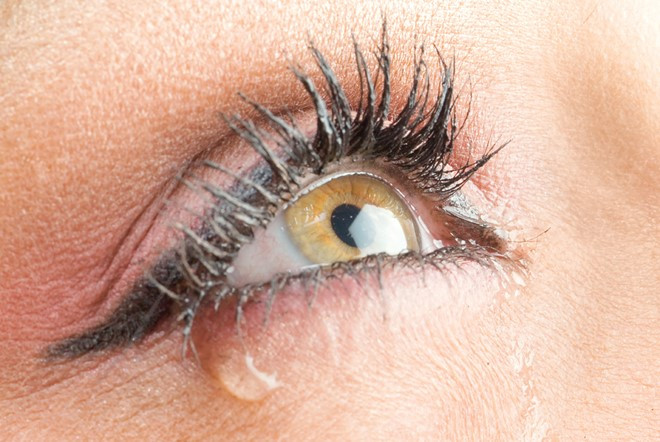 Picture 9 of 9 abnormal signs of eye health problems
