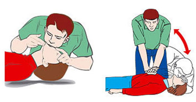 Picture 1 of 9 basic emergency skills everyone should know