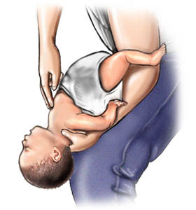 Picture 4 of 9 basic emergency skills everyone should know